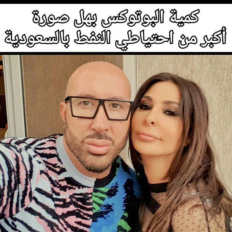 كمية البوتوكس بهل صورة اكبر من احتياطي النفط بالسعودية